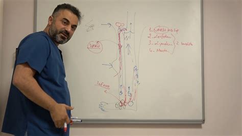 lv segmenter duvar hareket bozukluğu nedir|Prof. Dr. Ahmet Akgül .